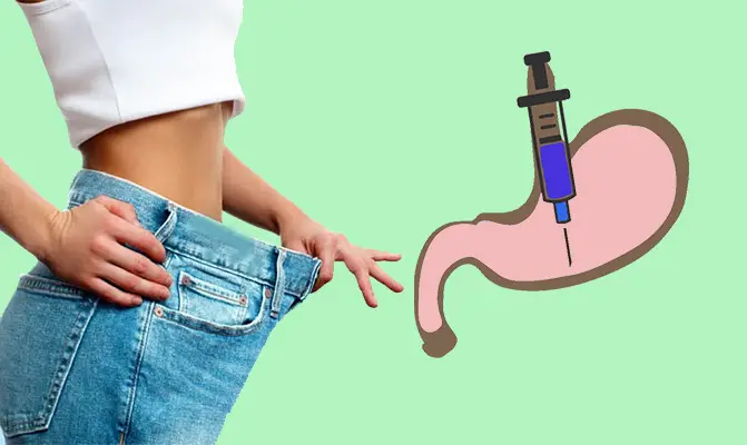 بوتاکس معده برای لاغری و کاهش وزن سریع