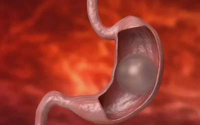 مراقبتهای بعد از بوتاکس معده شامل چه مواردی است؟